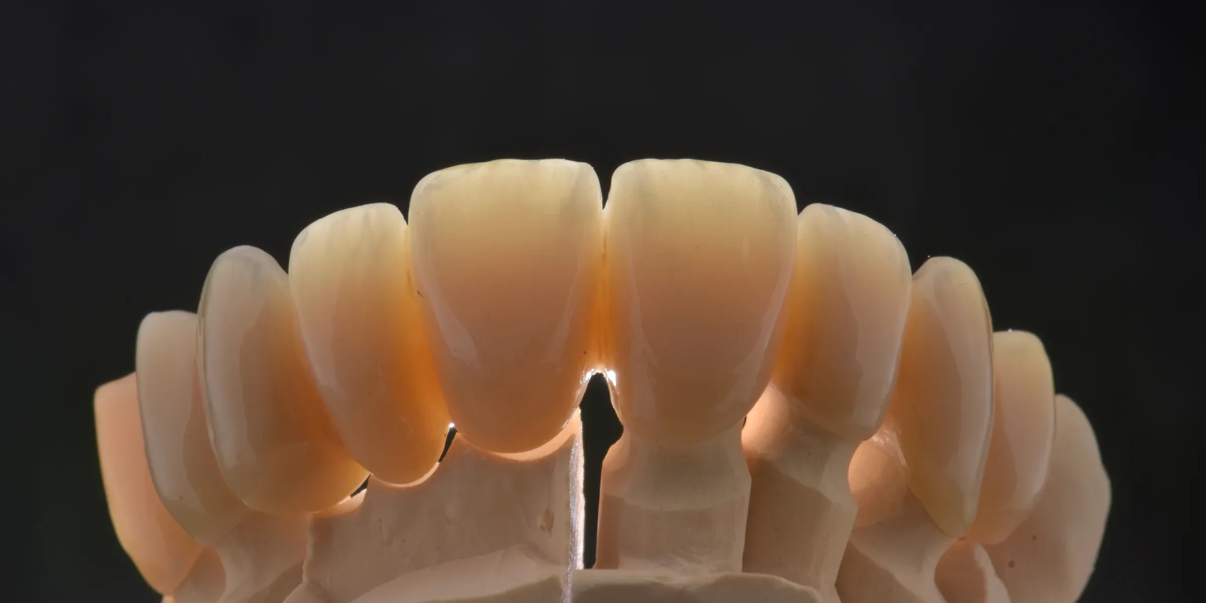 2423661_Header_2423708_Katana_YML_Management_Dental_Lab